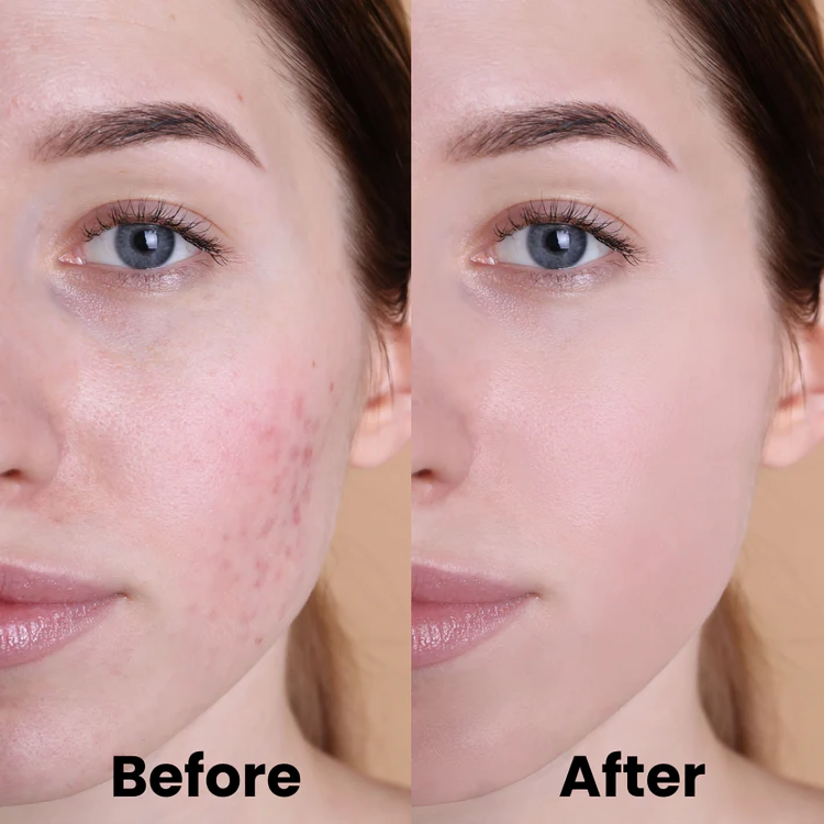 Turmeric Kojic Acid Pads for Radiant Skin