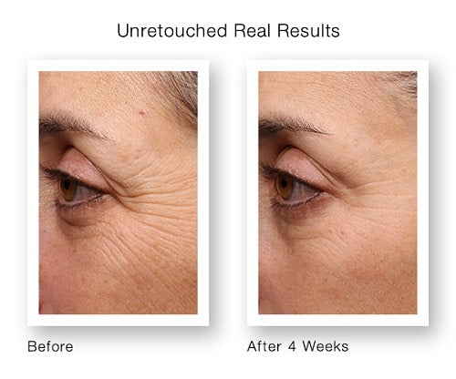 Anti-Aging Serum with Retinol