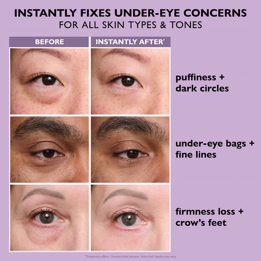 Revitalizing Eye Tightener | Instant Lifting Effect | Smooths Eye Area