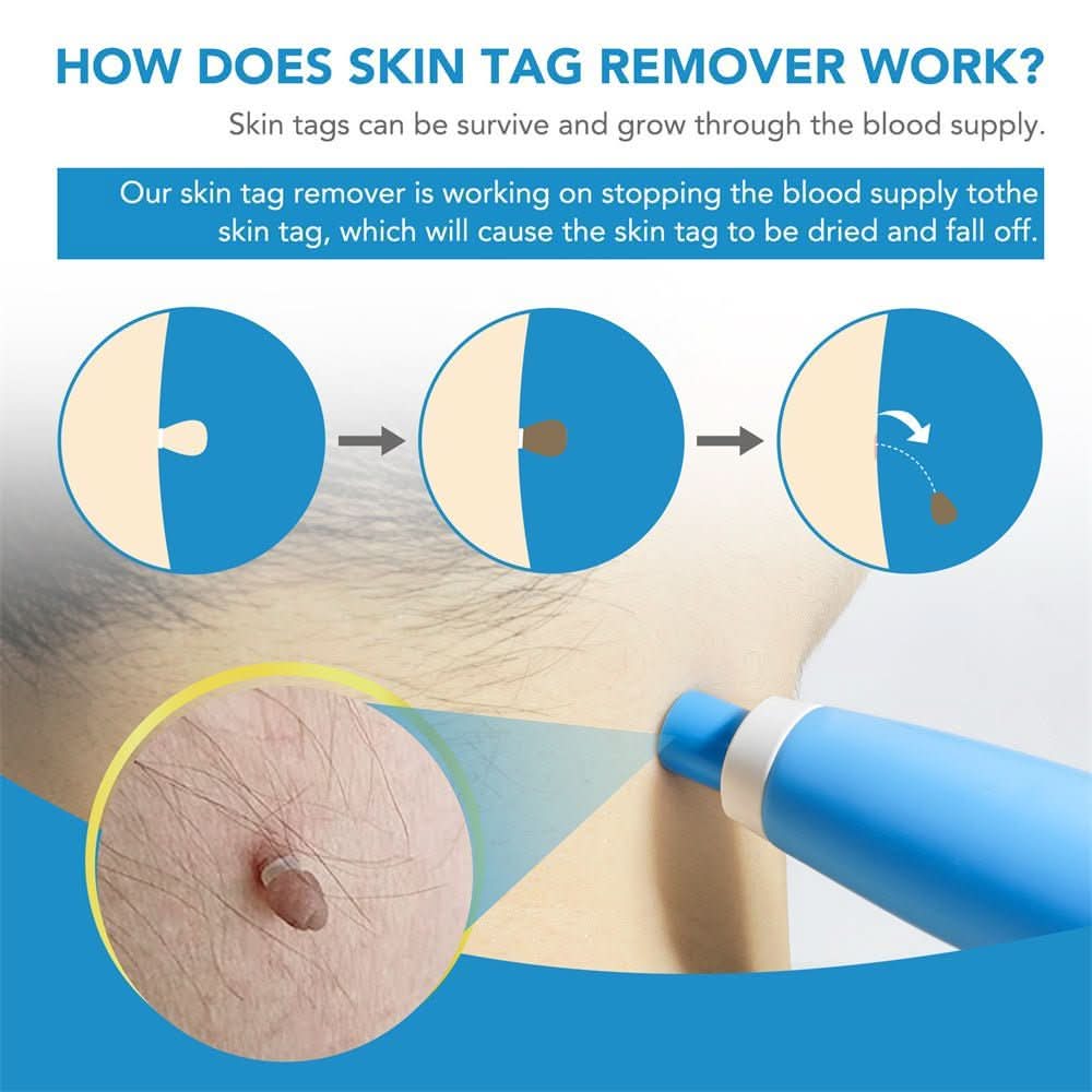 Skin Spot Remover Tool for Easy Application