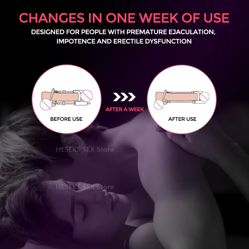Advanced Male Enhancement Traction System for Growth