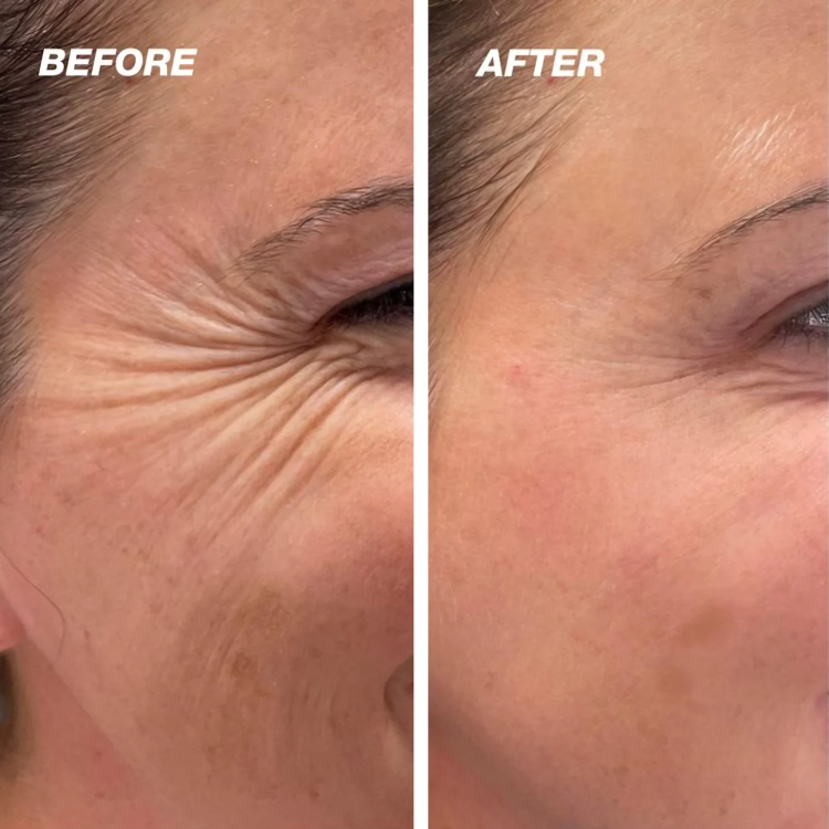 Silicone Scar Sheets for Skin Repair