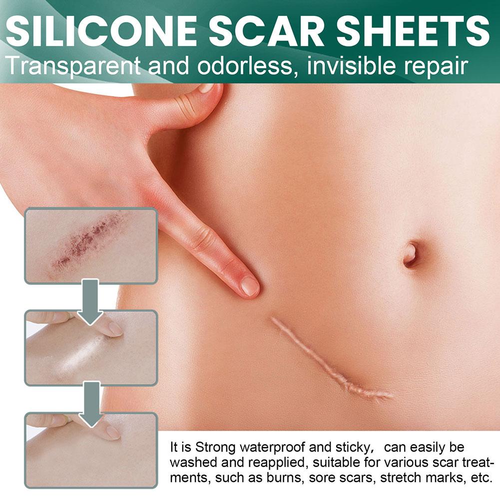 Silicone Scar Sheets for Skin Repair