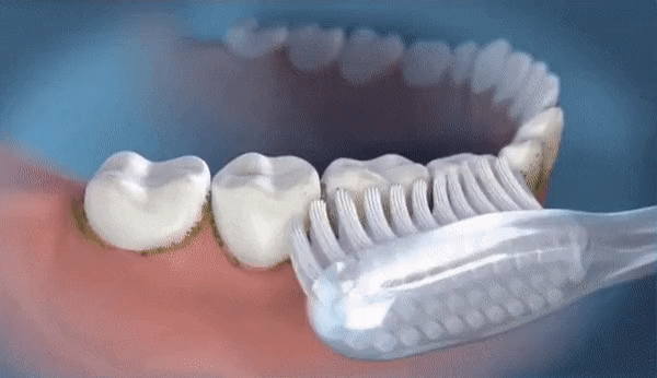 Electric Oral Irrigator | 3 Pressure Levels | 360° Nozzle