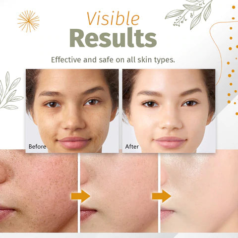 Organic Serum for Spot Treatment – Clear Skin Solution