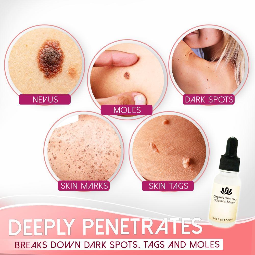 Organic Serum for Spot Treatment – Clear Skin Solution
