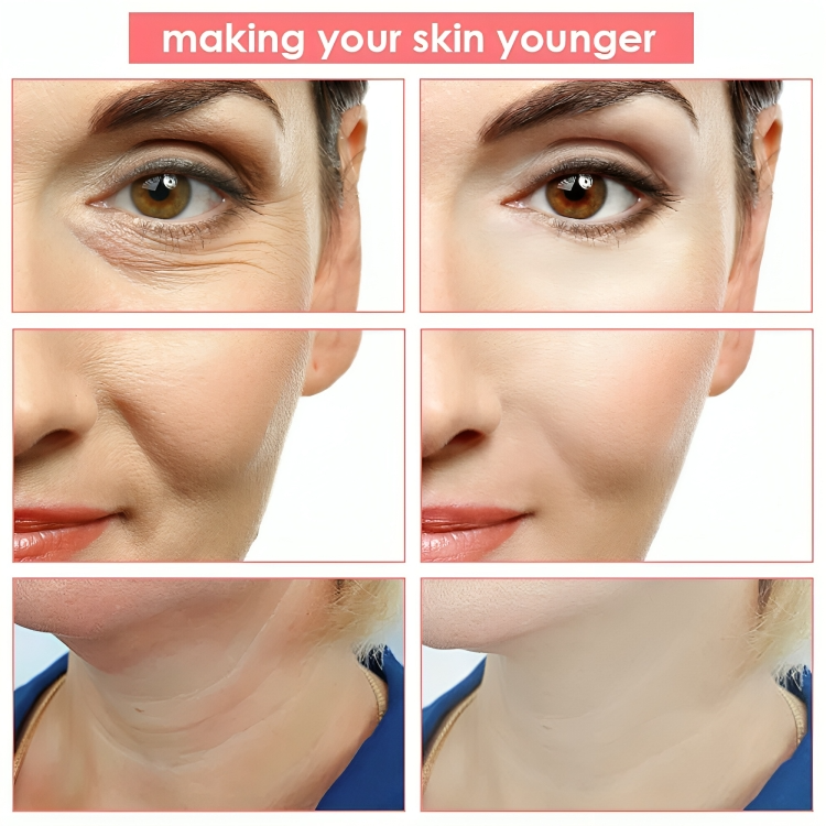Facial Massage for Skin Tightening – ToneLift Device