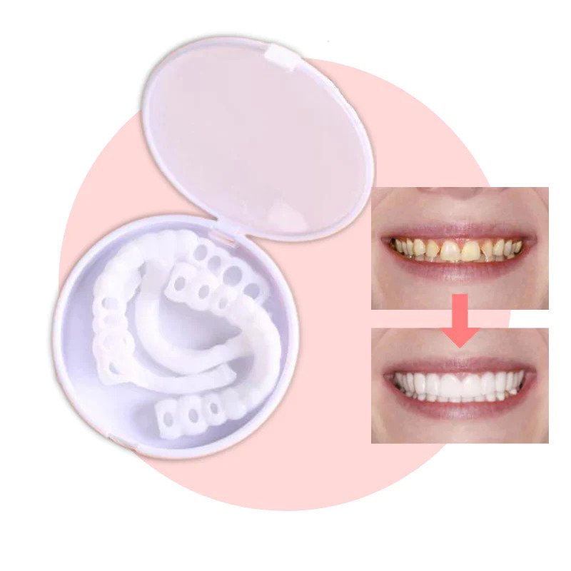 Flexible Fit Veneers without Adhesive for Eating, Drinking, and Daily Use