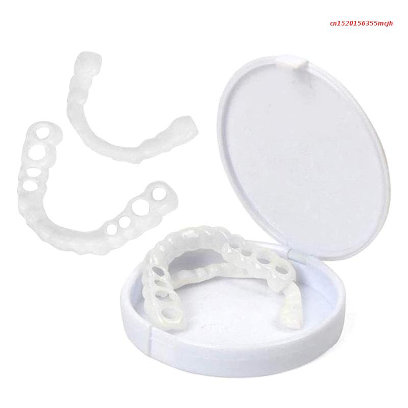 Flexible Fit Veneers without Adhesive for Eating, Drinking, and Daily Use