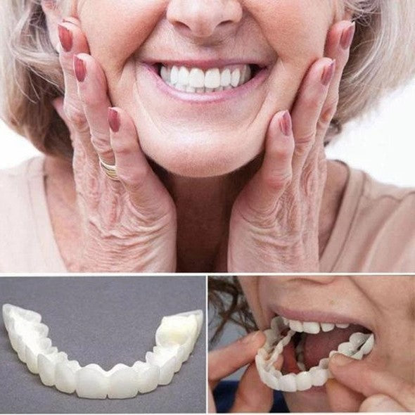 Ultra-Thin Acrylic Resin Veneers for Instant Smile Transformation