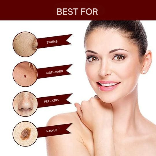 Wart Remover with Precision Applicator for Targeted Treatment – Herbal Formula