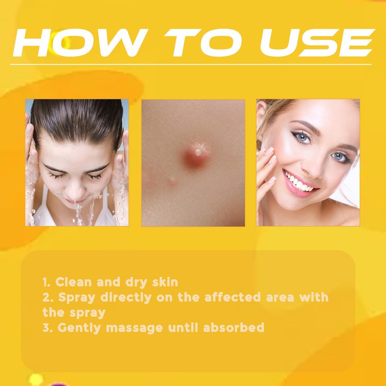 Wart Remover | Targeted Skin Spray | Bee Venom Care Formula