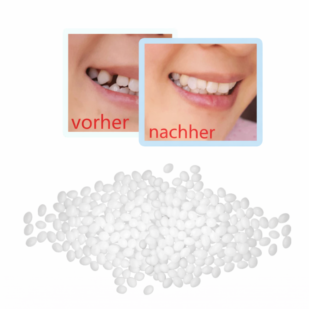 Tooth Repair Kit with Mouldable Material