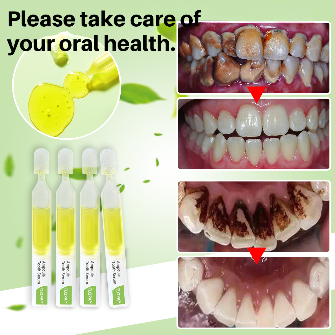 Teeth Whitening and Tartar Removal with Natural Ingredients