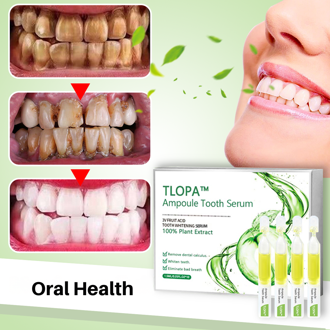 Teeth Whitening and Tartar Removal with Natural Ingredients
