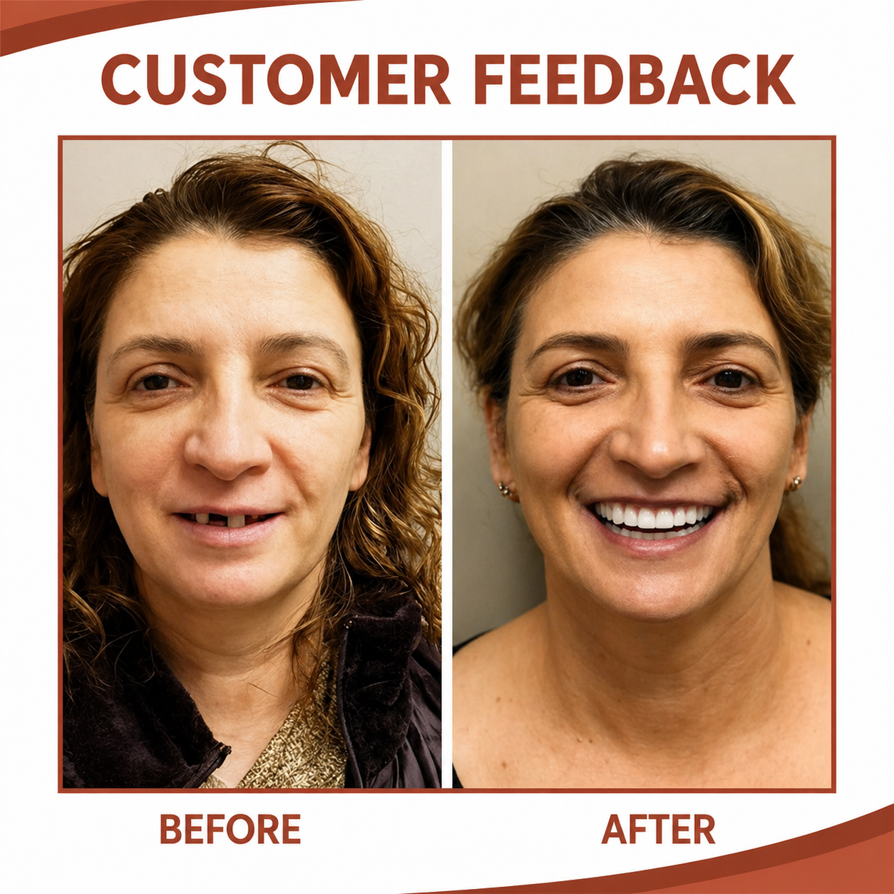 Dental Replacement | Soft Silicone Cushion | Non-Slip Fit Without Pressure Points