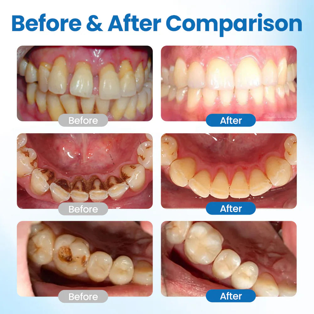Tooth Protection Serum for Sensitive Teeth Care