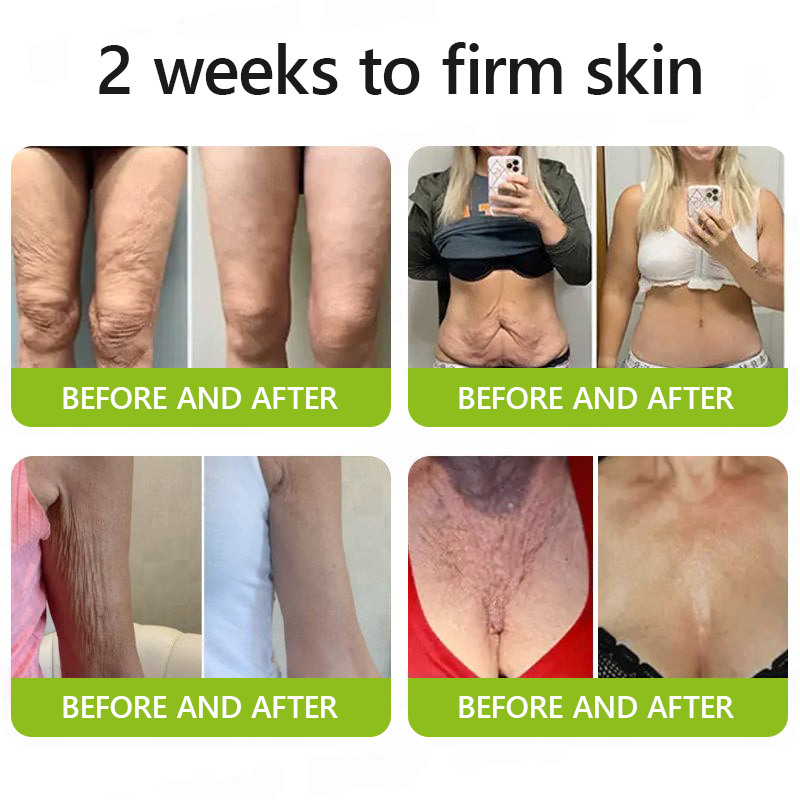 LysoriaLift™ — Reveal Firmer, Radiant Skin That Turns Back Time Without Needles