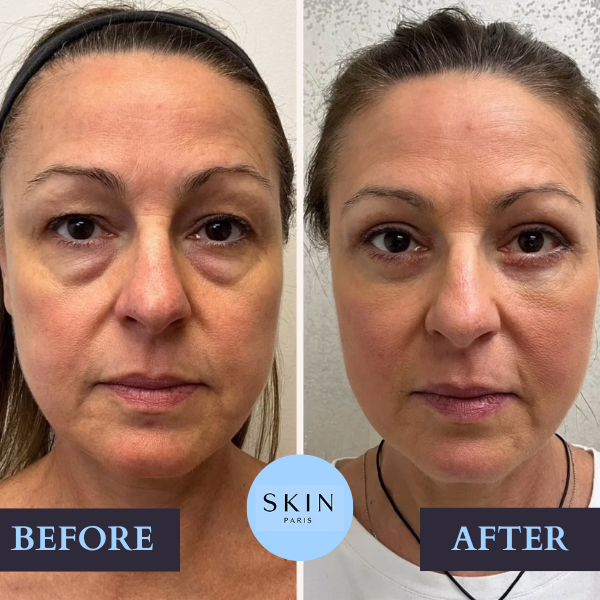 GloraLift™ — Reveal Radiant, Youthful Skin That Turns Heads Every Day