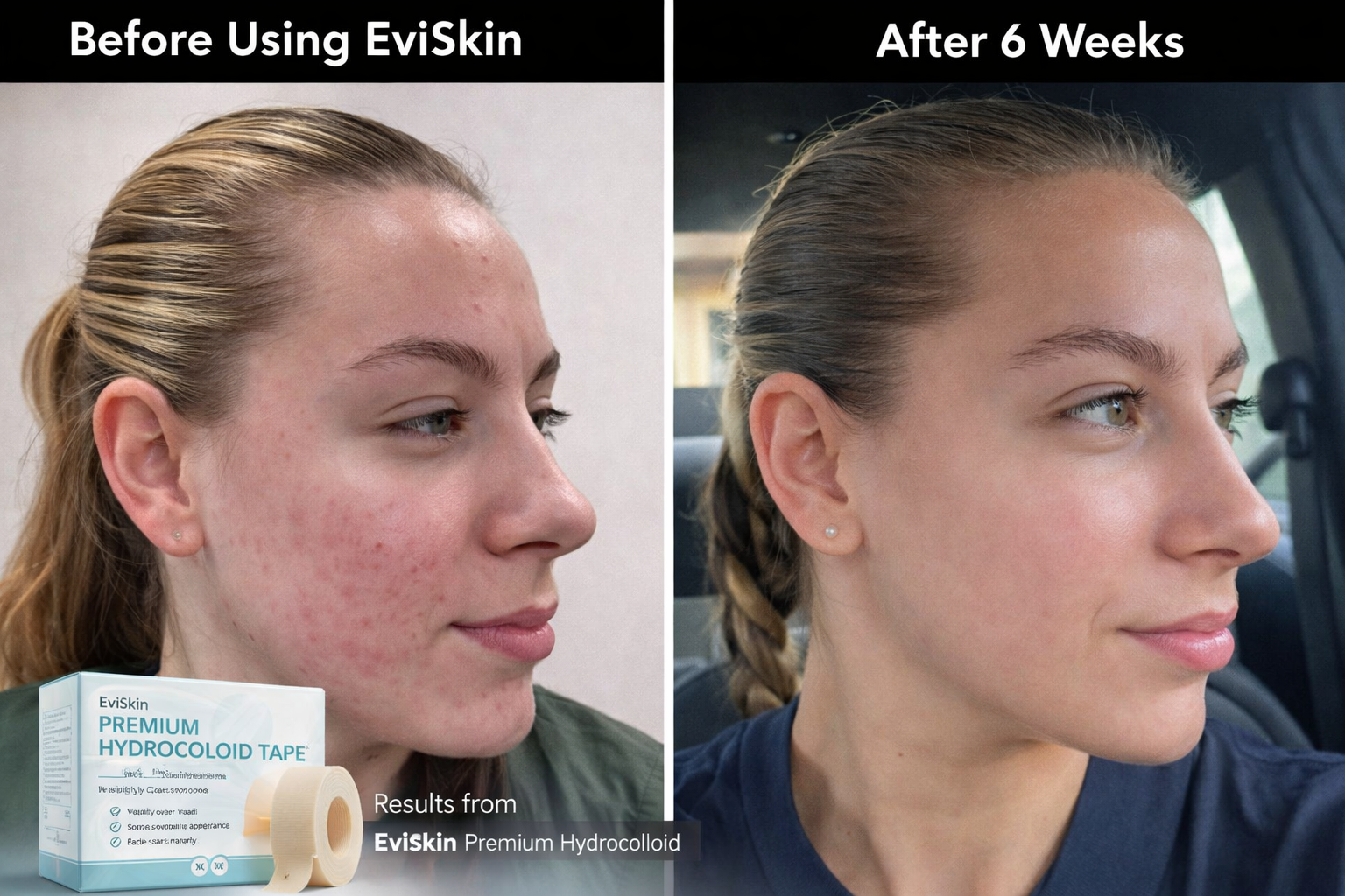 GlimmerHeal™ Rapid Rescue — Crush Pimples Fast and Reveal Your Most Confident Skin