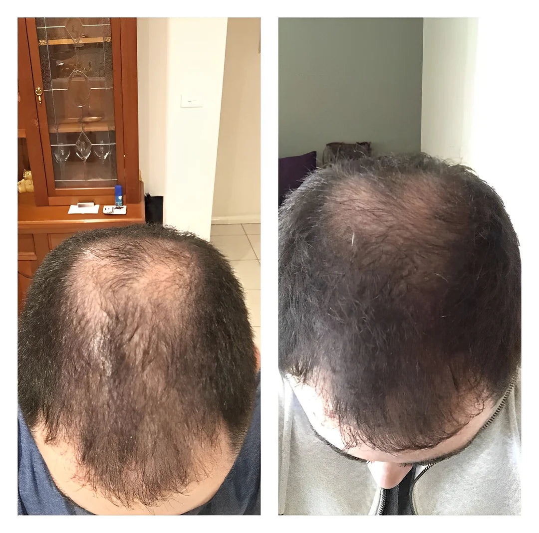 SilkRoot™ Rice Water Shampoo Bar — Revive Your Hair’s Full, Lush Glory with Every Wash