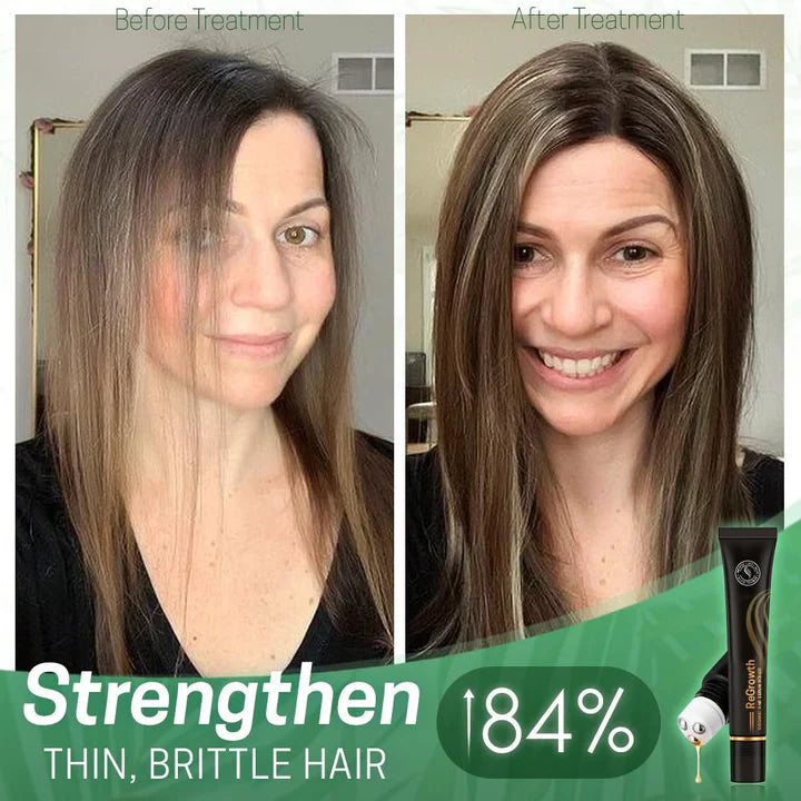 RevitaLuxe™ Hair Serum Roller — Unleash Thick, Radiant Hair That Commands Every Glance