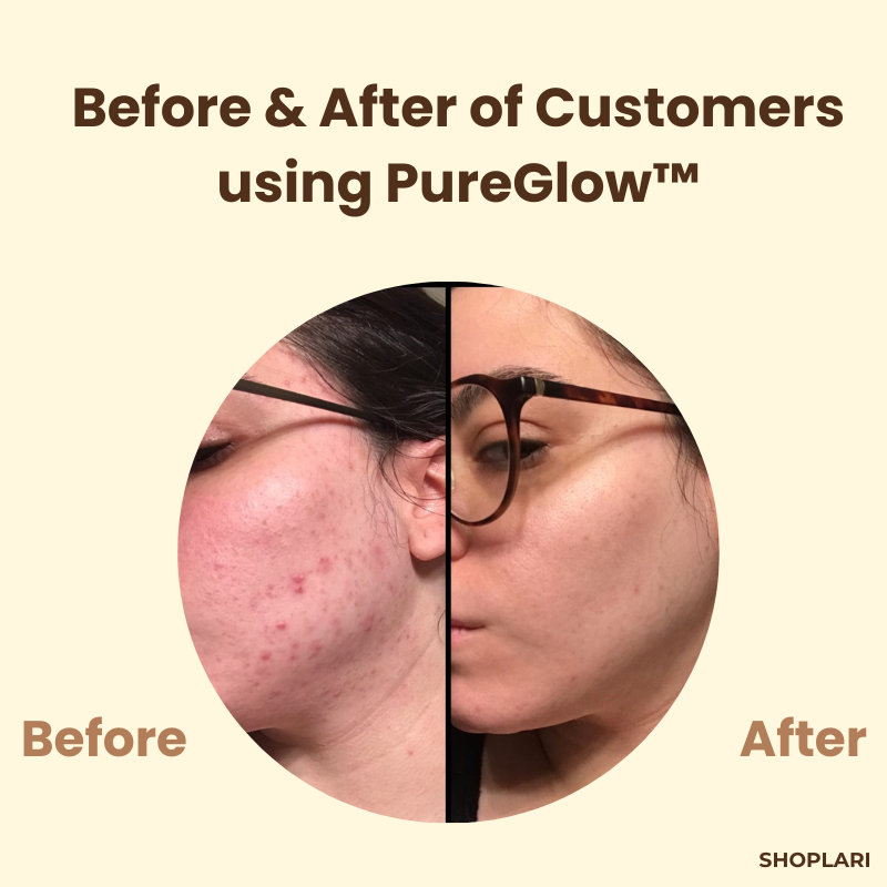LumaBloom™ — Reveal Radiant, Spot-Free Skin That Turns Heads Instantly