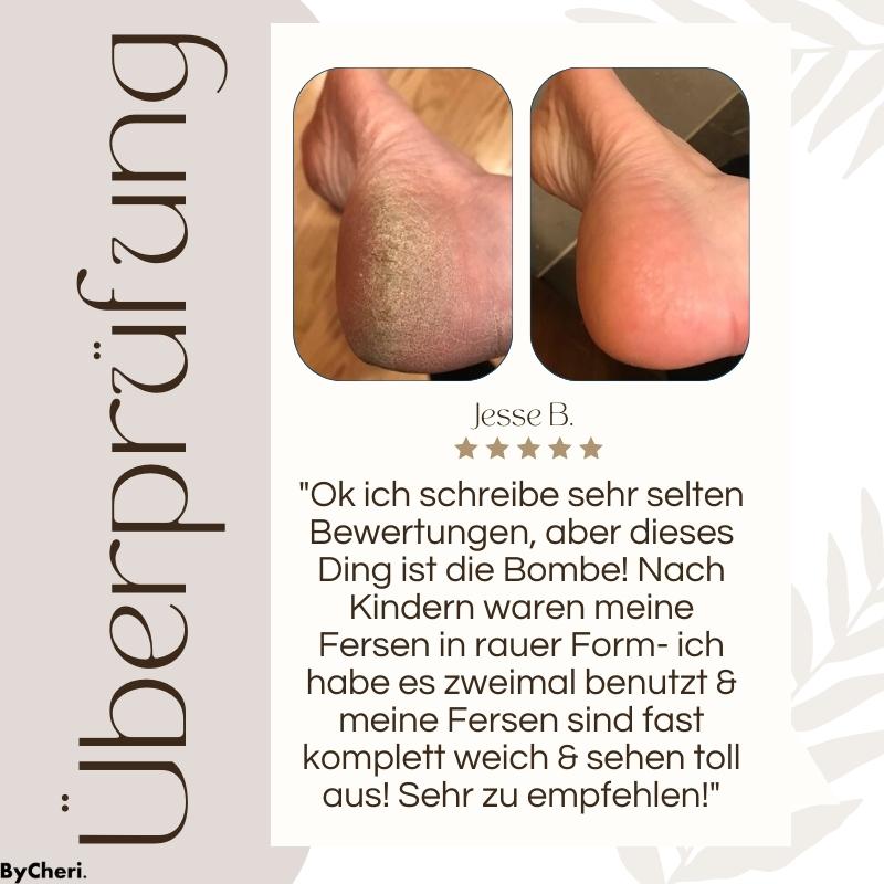 VelvetStep™ — Effortless Salon-Soft Feet That Boost Your Confidence Instantly