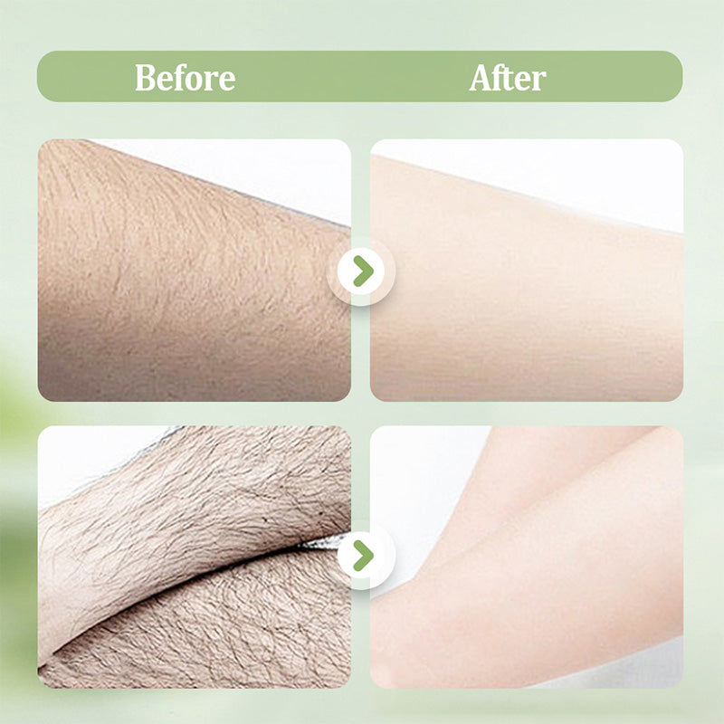 Velvett™ — Unlock Silky, Smooth Skin Without Pain or Stubble