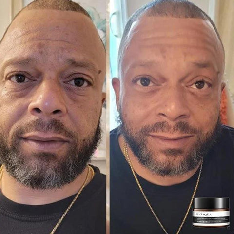 RamoraLift™ — Reveal Radiant, Youthful Eyes Instantly