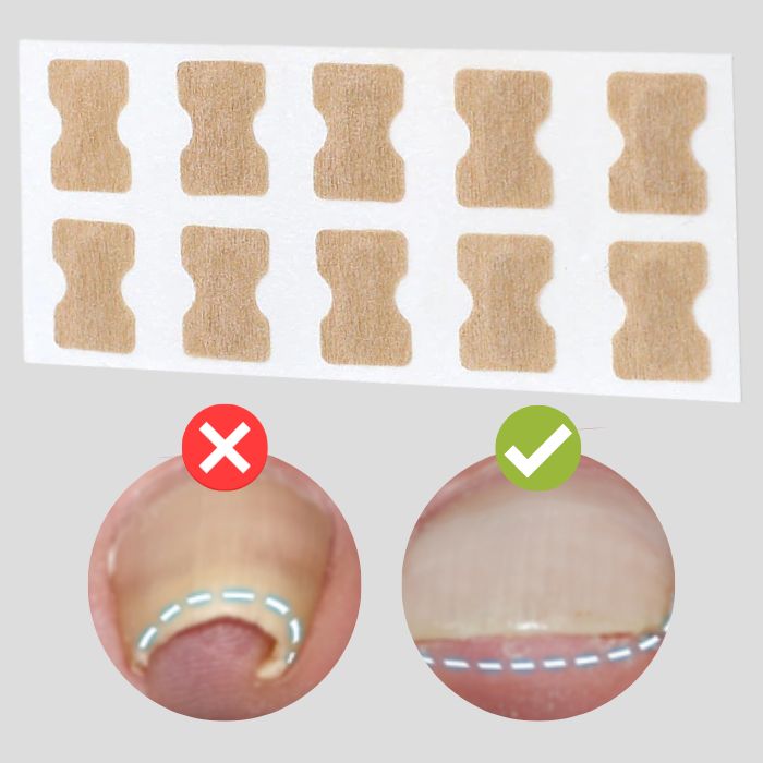 NailRevive™ — Walk Pain-Free and Proud with Perfectly Restored Nails