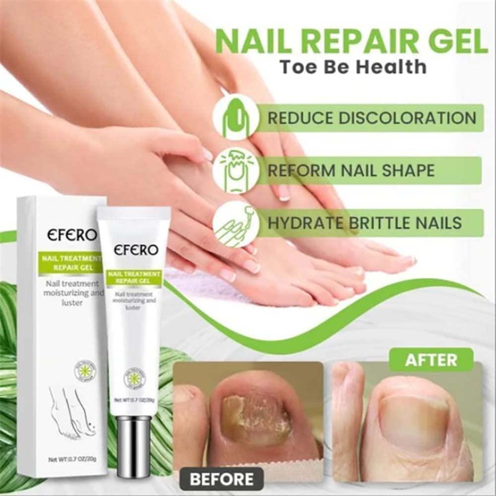 VeraNex™ Repair Gel — Transform Fragile Nails Into Stunning Strength You Can Flaunt