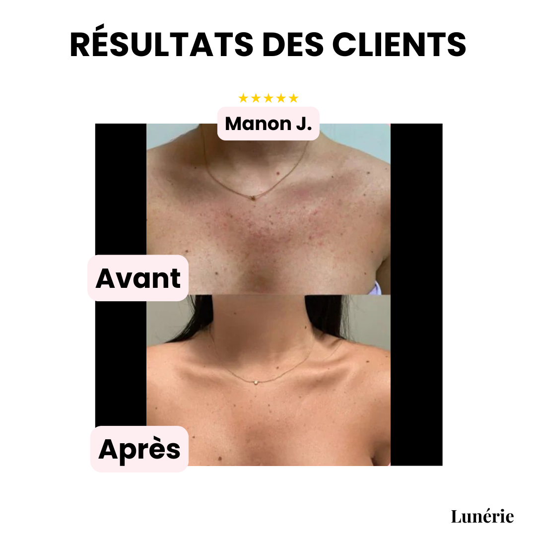 SilkVeil™ — Reveal Radiant, Flawless Skin That Lasts for Days