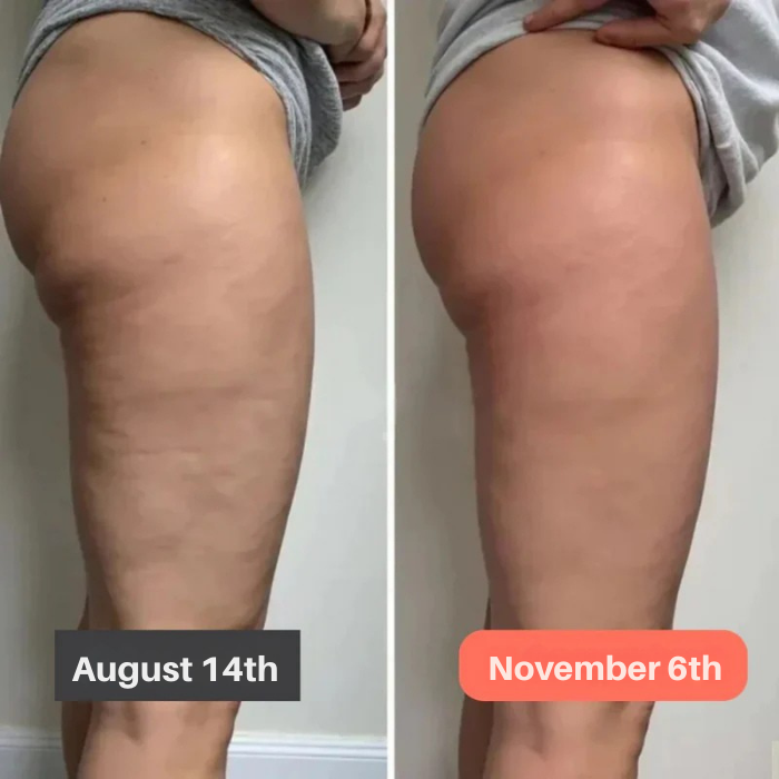 VitaSculpt™ Leggings — Ignite Power and Smooth Every Curve for Legs You’ll Proudly Flaunt