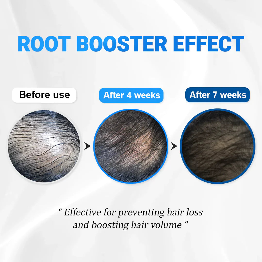 Berelli Hair Growth Scalp Ampoule™ — Unlock Thick, Strong Hair That Turns Heads Fast