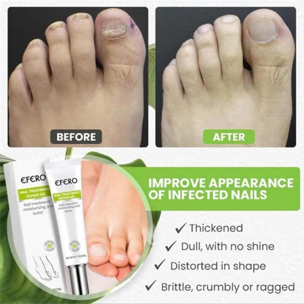 VeraNex™ Repair Gel — Transform Fragile Nails Into Stunning Strength You Can Flaunt