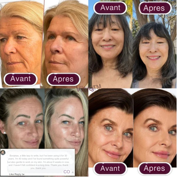 LumiSculpt™ — Unlock Radiant, Youthful Skin That Turns Heads