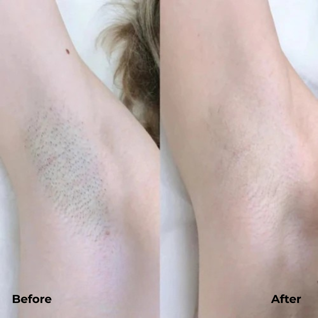 GlideLuxe™ — Effortless Smooth Legs That Feel Absolutely Pampered Every Day