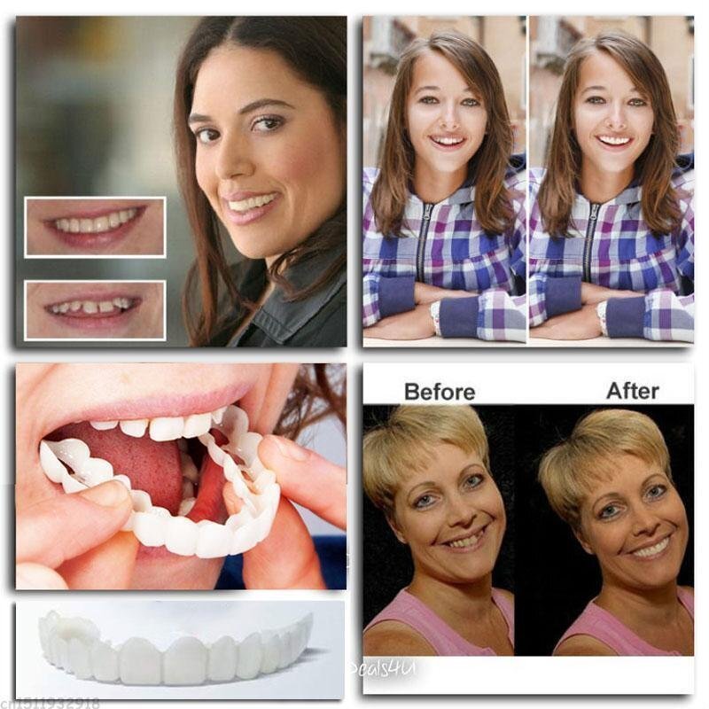 LumaPearl™ Smile Shield — Instantly Own a Flawless Smile That Feels 100% You