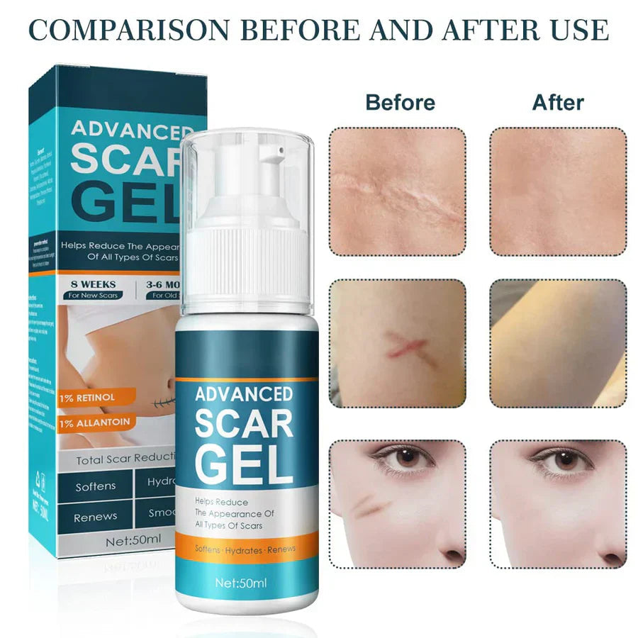 SilkSkin Elixir™ — Reveal Smooth, Radiant Skin That Builds Your Confidence Every Day