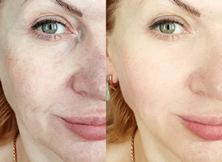 RadianceBurst™ — Melt Away Dark Spots for Skin That Glows Confidence