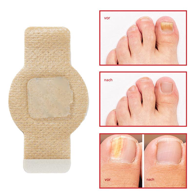 ClearVita™ Nail Renewal Patches — Reveal Stunning, Healthy Nails Without the Hassle