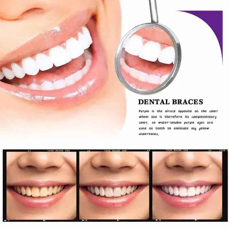 RadiantMist™ Serum — Instantly Brighten Your Smile Without Pain or Sensitivity
