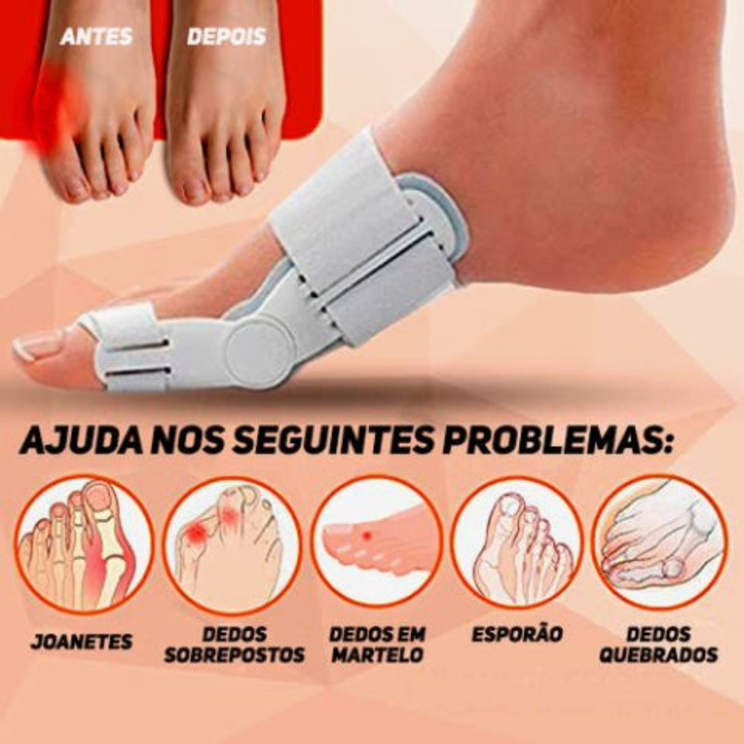 FlexiStep™ Toe Stabilizer — Pain-Free Steps and Confident Feet Every Day