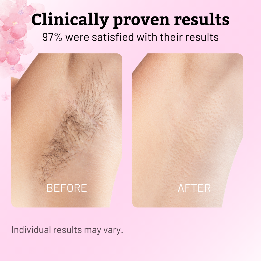SilkaPure™ — Experience Pain-Free Softness and Watch Hair Retreat in Just One Week