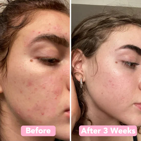 LumiFleur™ Radiance Pads — Wake Up to Instantly Brighter, Smoother, Spotless Skin