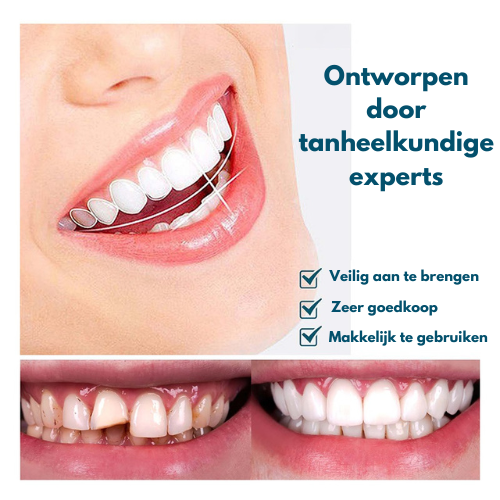 GlideSmile™ — Snap On a Stunning Smile That Turns Heads Instantly