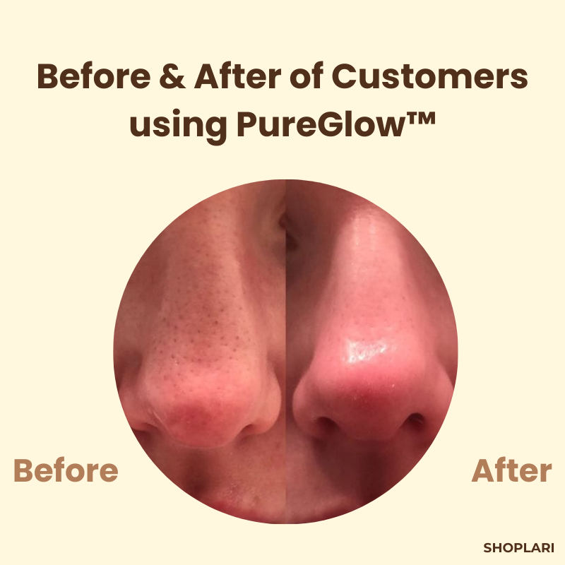 LumaBloom™ — Reveal Radiant, Spot-Free Skin That Turns Heads Instantly