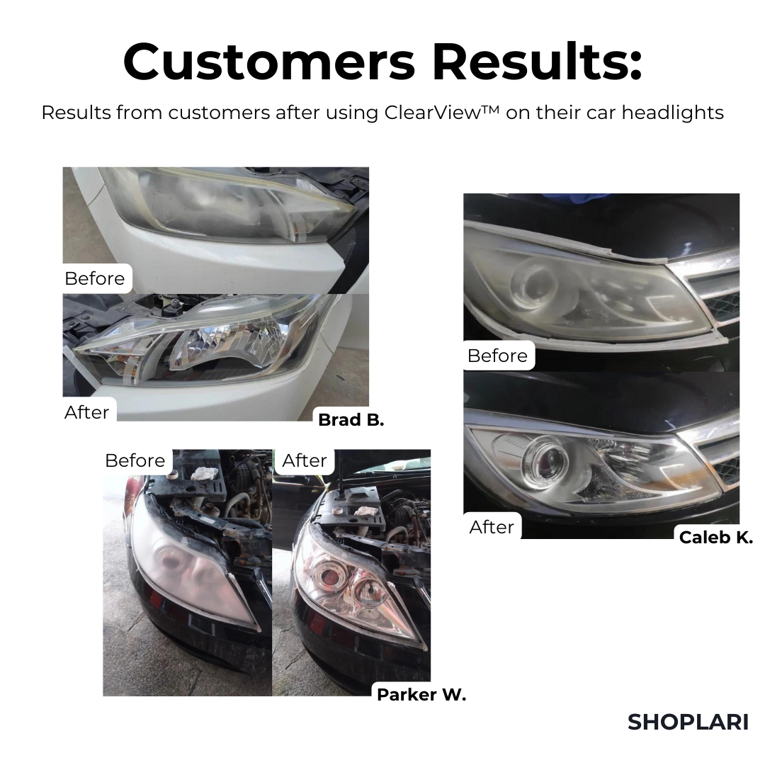 LumaShield™ — Reignite Your Headlights for Safer, Brighter Night Drives