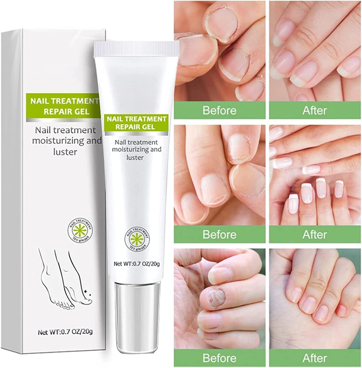 VeraNex™ Repair Gel — Transform Fragile Nails Into Stunning Strength You Can Flaunt